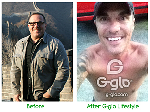 G-glo Before and After Chris f